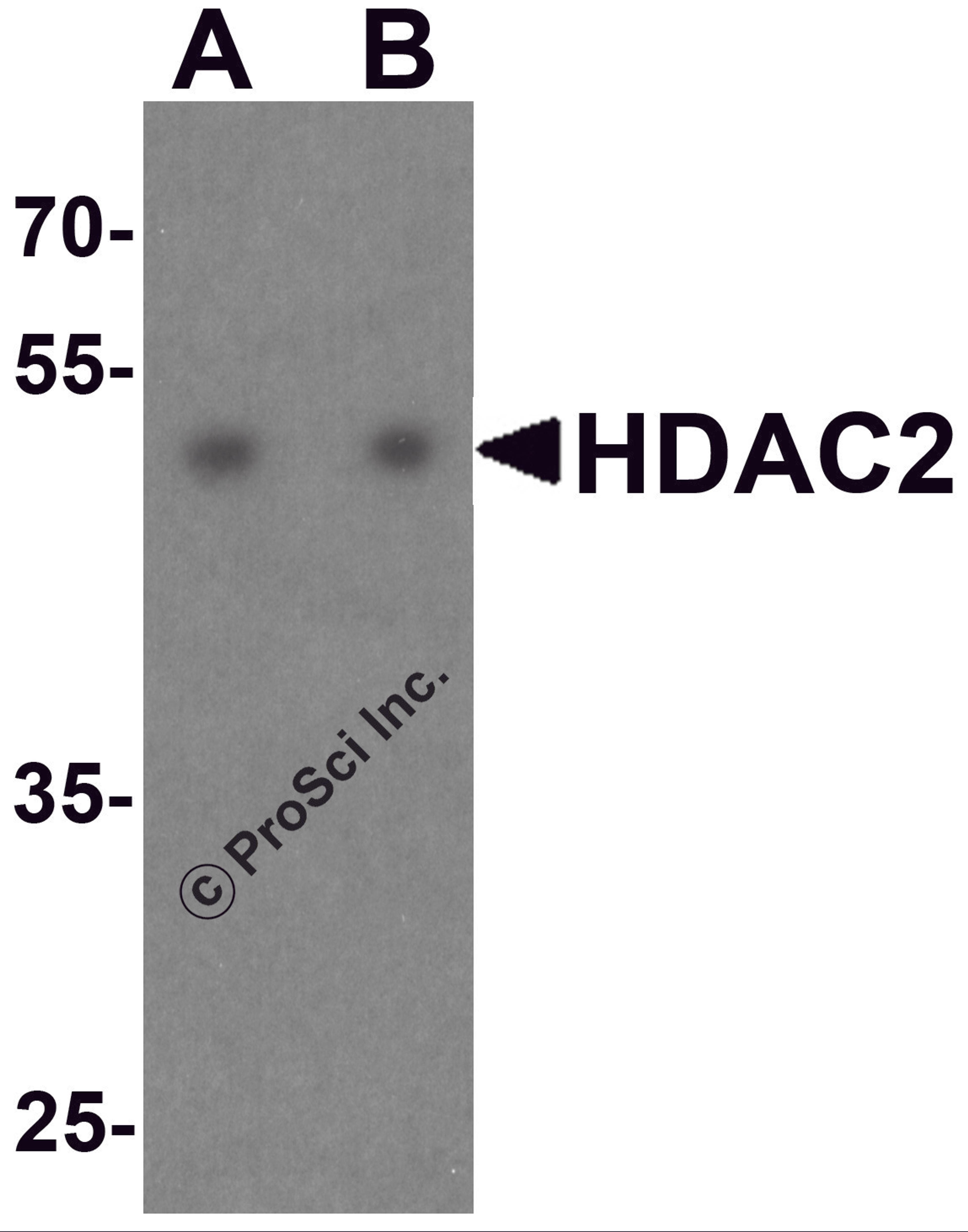 Western blot analysis of HDAC2 in HeLa cell lysate with HDAC2 antibody at (A) 0.5 and (B) 1 μg/ml.