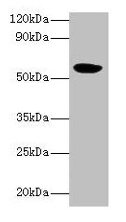 Western blot. All lanes: HARS2 antibody at 2µg/ml + Mouse kidney tissue. Secondary. Goat polyclonal to rabbit IgG at 1/10000 dilution. Predicted band size: 57, 55 kDa. Observed band size: 57 kDa