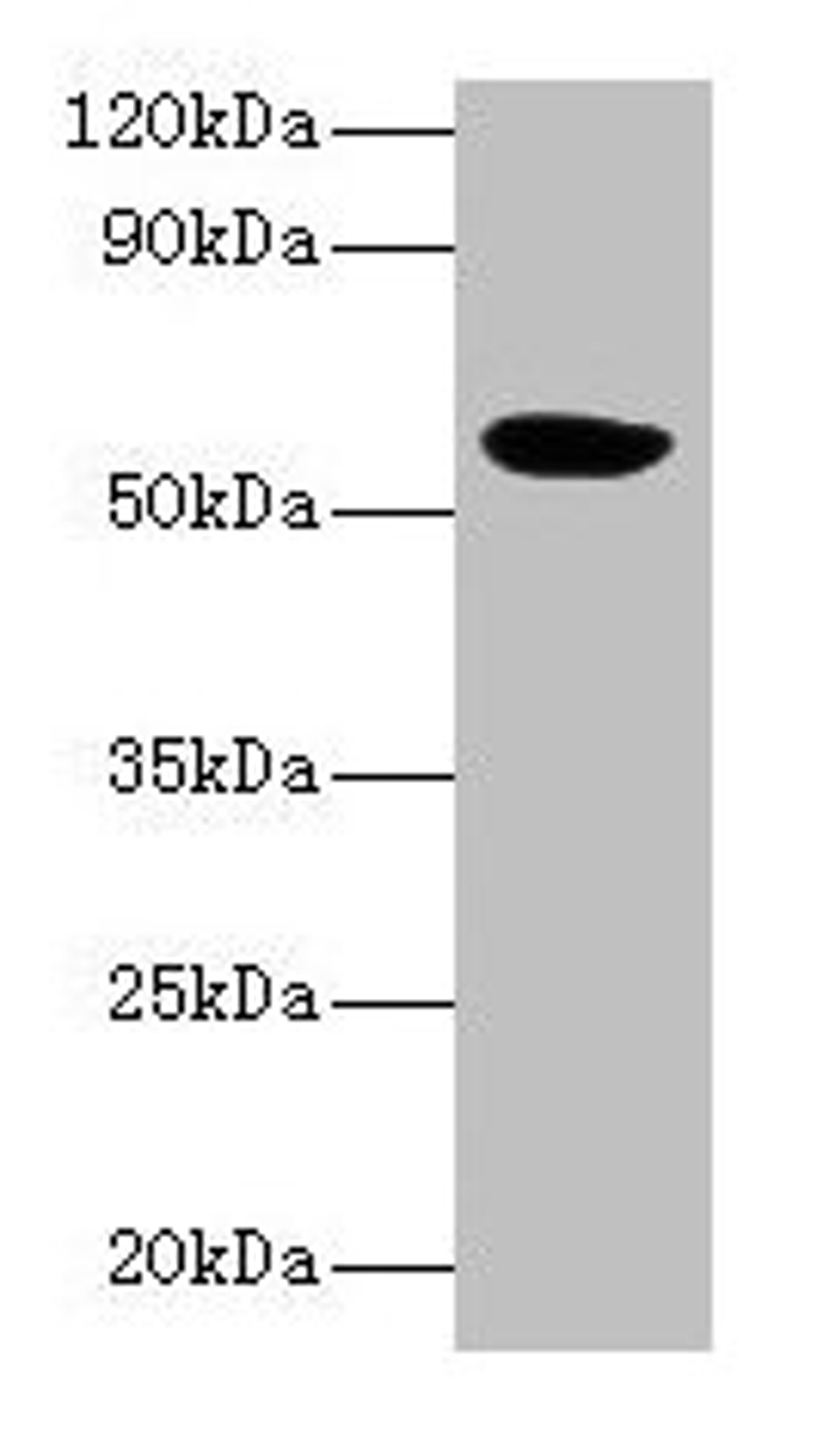 Western blot. All lanes: HARS2 antibody at 2µg/ml + Mouse kidney tissue. Secondary. Goat polyclonal to rabbit IgG at 1/10000 dilution. Predicted band size: 57, 55 kDa. Observed band size: 57 kDa
