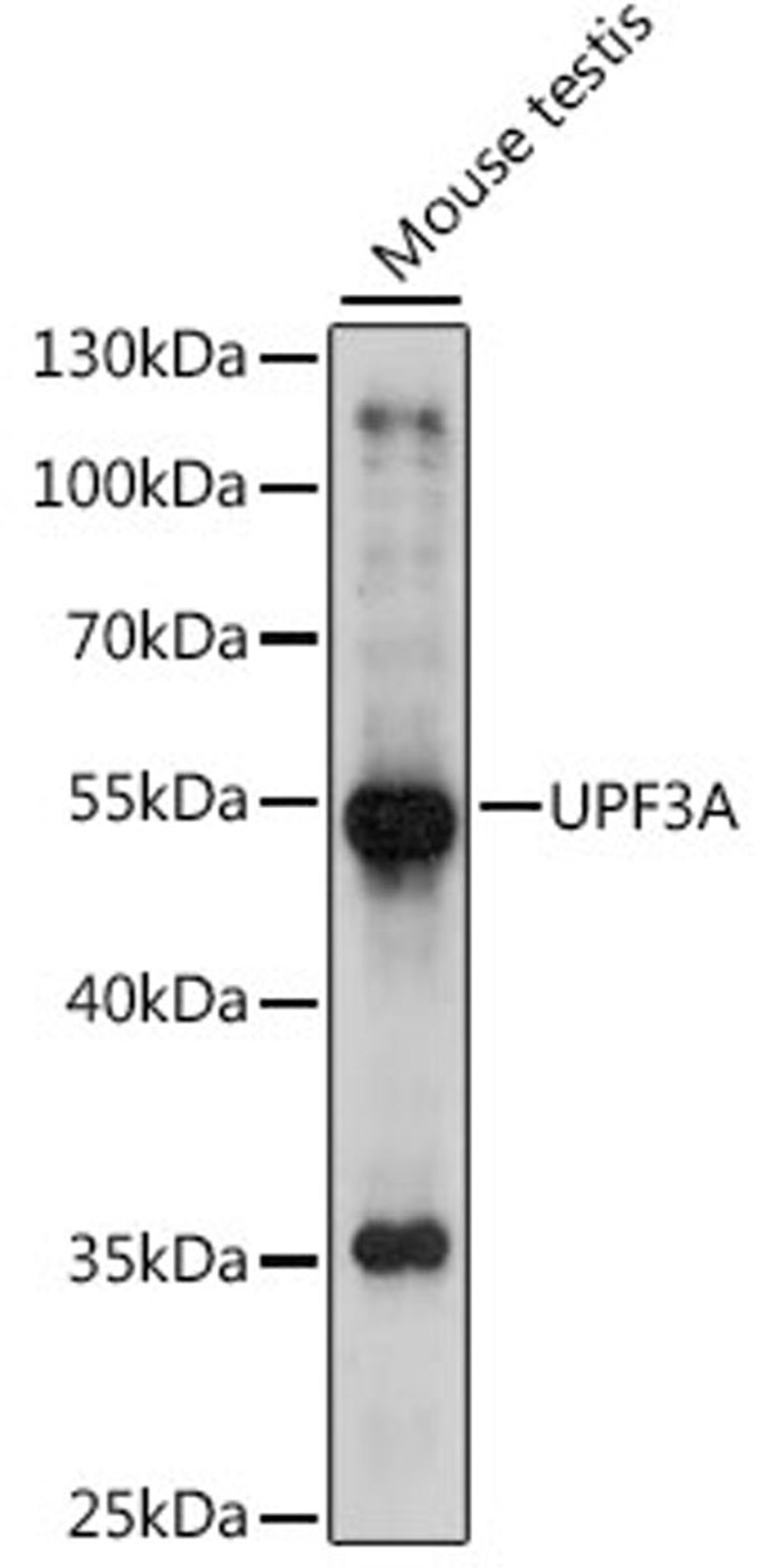 Western blot - UPF3A antibody (A15893)