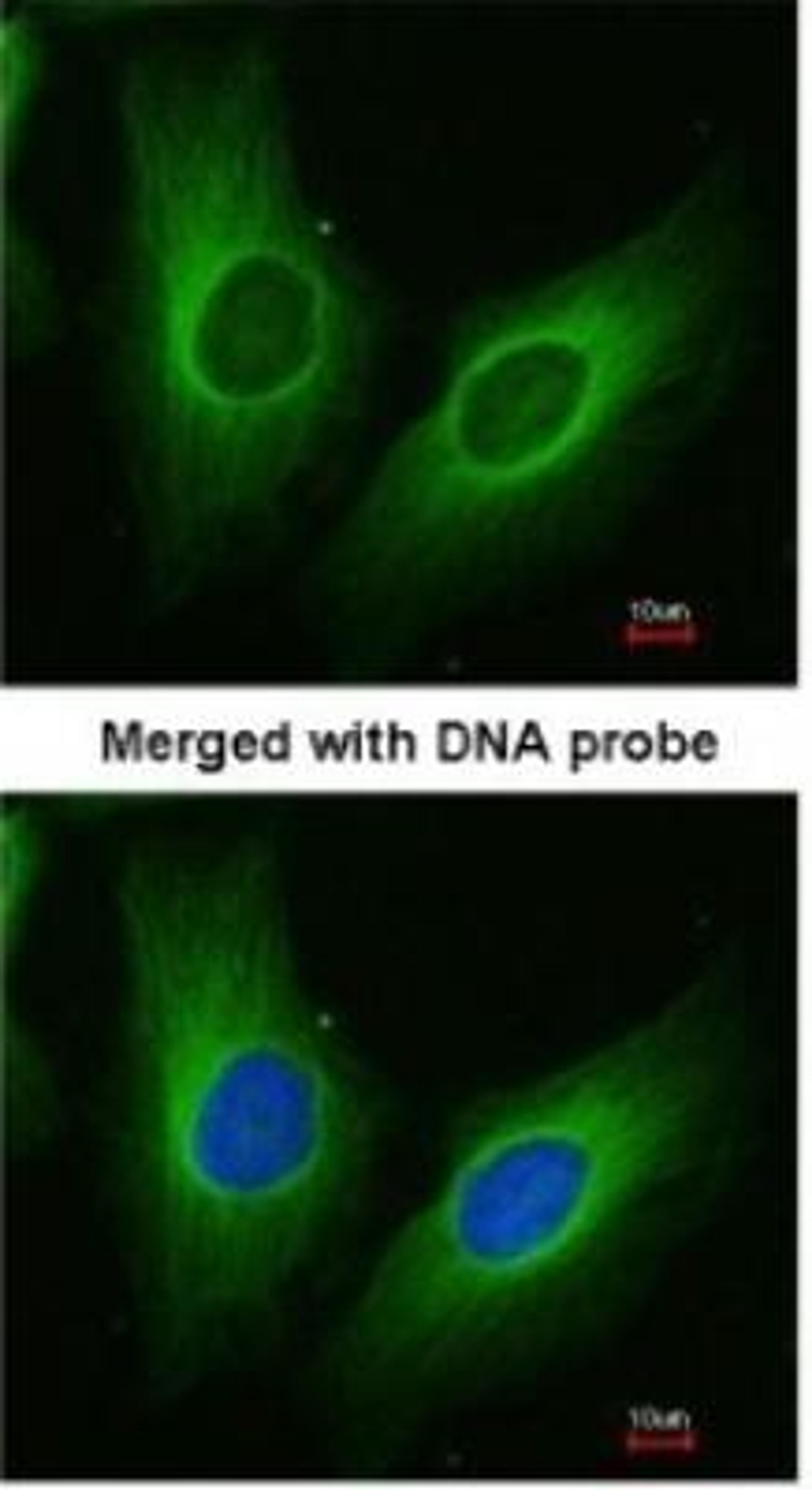 Immunocytochemistry/Immunofluorescence: Aldo-keto Reductase 1C3/AKR1C3 Antibody [NBP1-31378] - Paraformaldehyde-fixed HeLa, using antibody at 1:200 dilution.