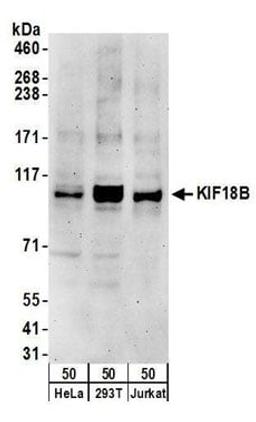 Detection of human KIF18B by western blot.