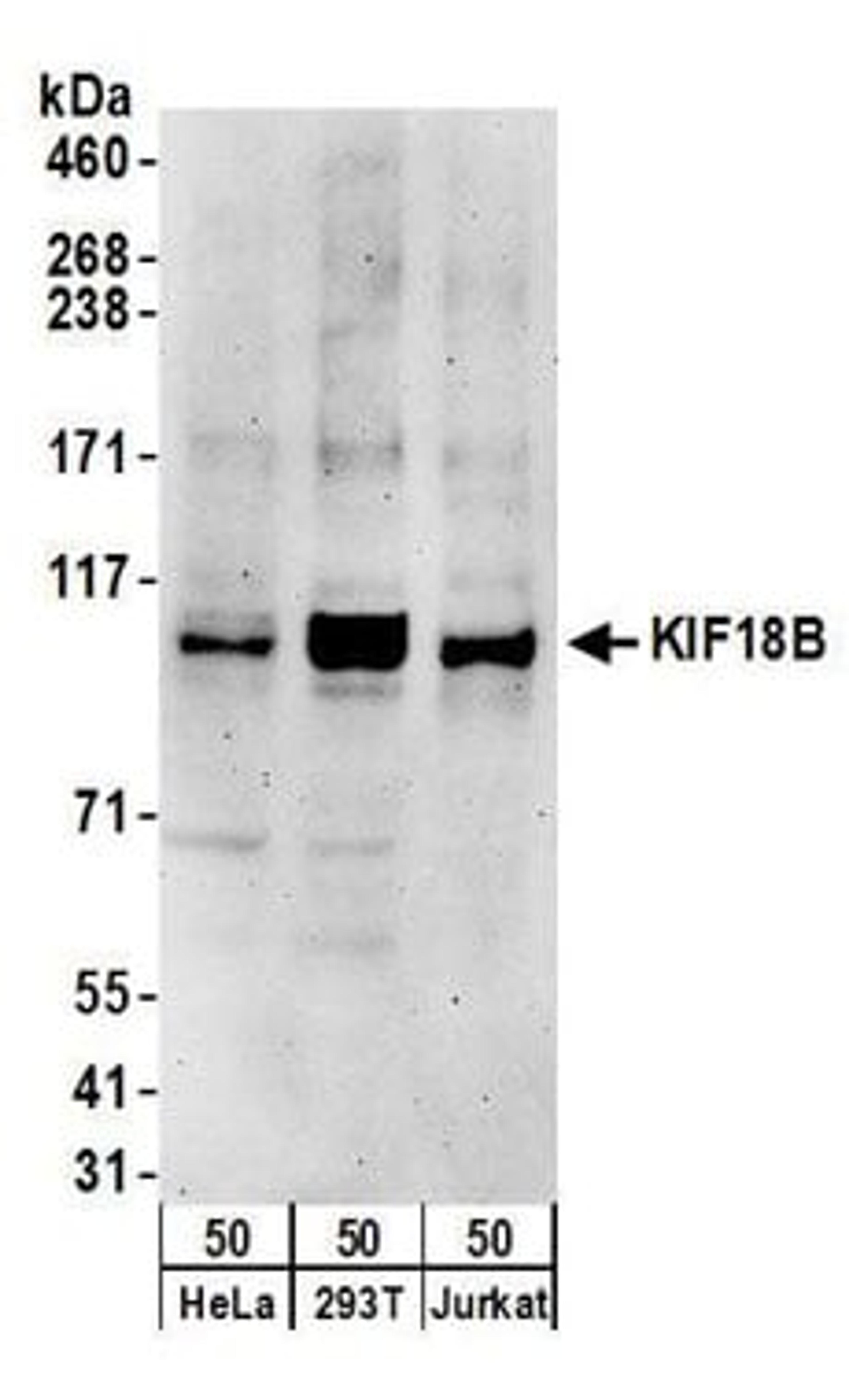 Detection of human KIF18B by western blot.