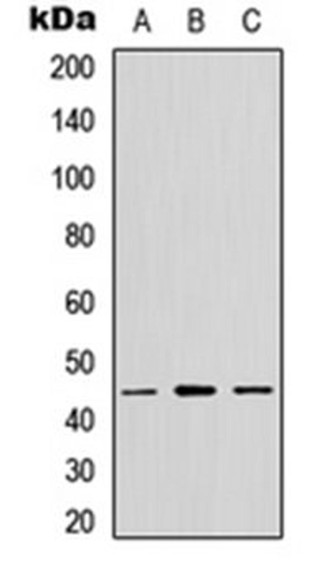 Western blot analysis of MCF7 (Lane 1), NS-1 (Lane 2), PC12 (Lane 3) whole cell lysates using GPR13 antibody