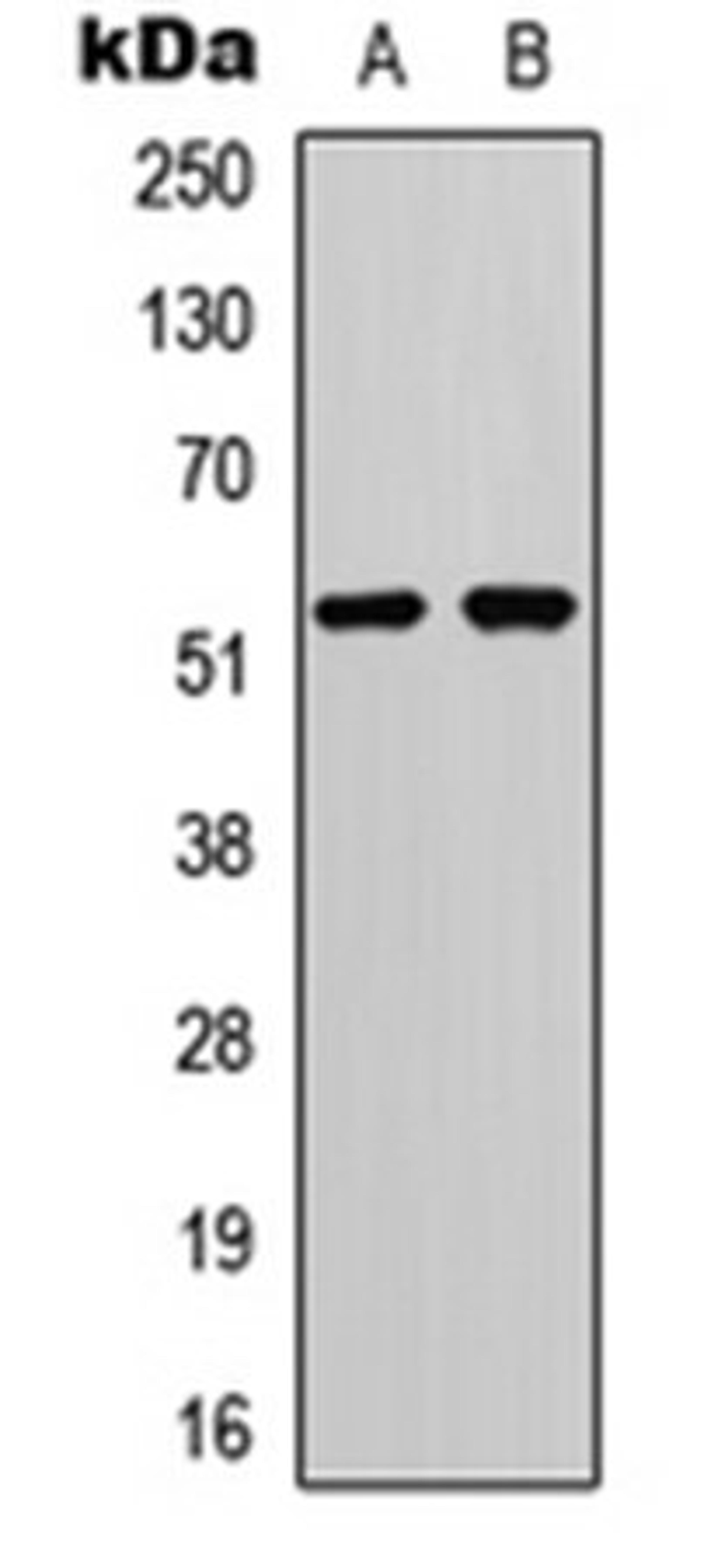 Western blot analysis of HCT116 (Lane 1), COS7 (Lane 2) whole cell lysates using p53 (Phospho-S20) antibody