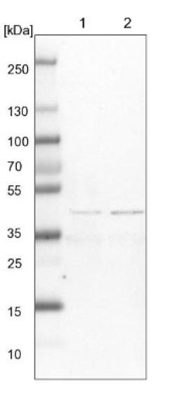 Western Blot: TXNL2 Antibody [NBP1-90021] - Lane 1: NIH-3T3 cell lysate (Mouse embryonic fibroblast cells)<br/>Lane 2: NBT-II cell lysate (Rat Wistar bladder tumour cells)