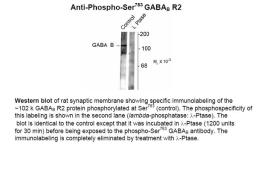 Western blot of rat synaptic membrane showing specific immunolabeling of the ~102 k GABAB R2 protein phosphorylated at Ser783 (control). The phosphospecificity of this labeling is shown in the second lane (lambda-phosphatase: lamda-Ptase). The blot is ide