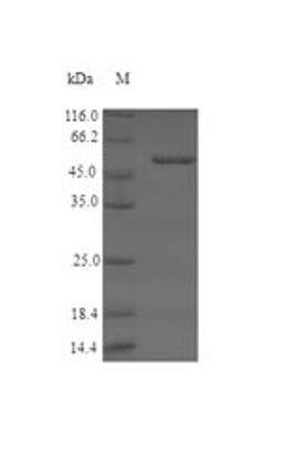 (Tris-Glycine gel) Discontinuous SDS-PAGE (reduced) with 5% enrichment gel and 15% separation gel.