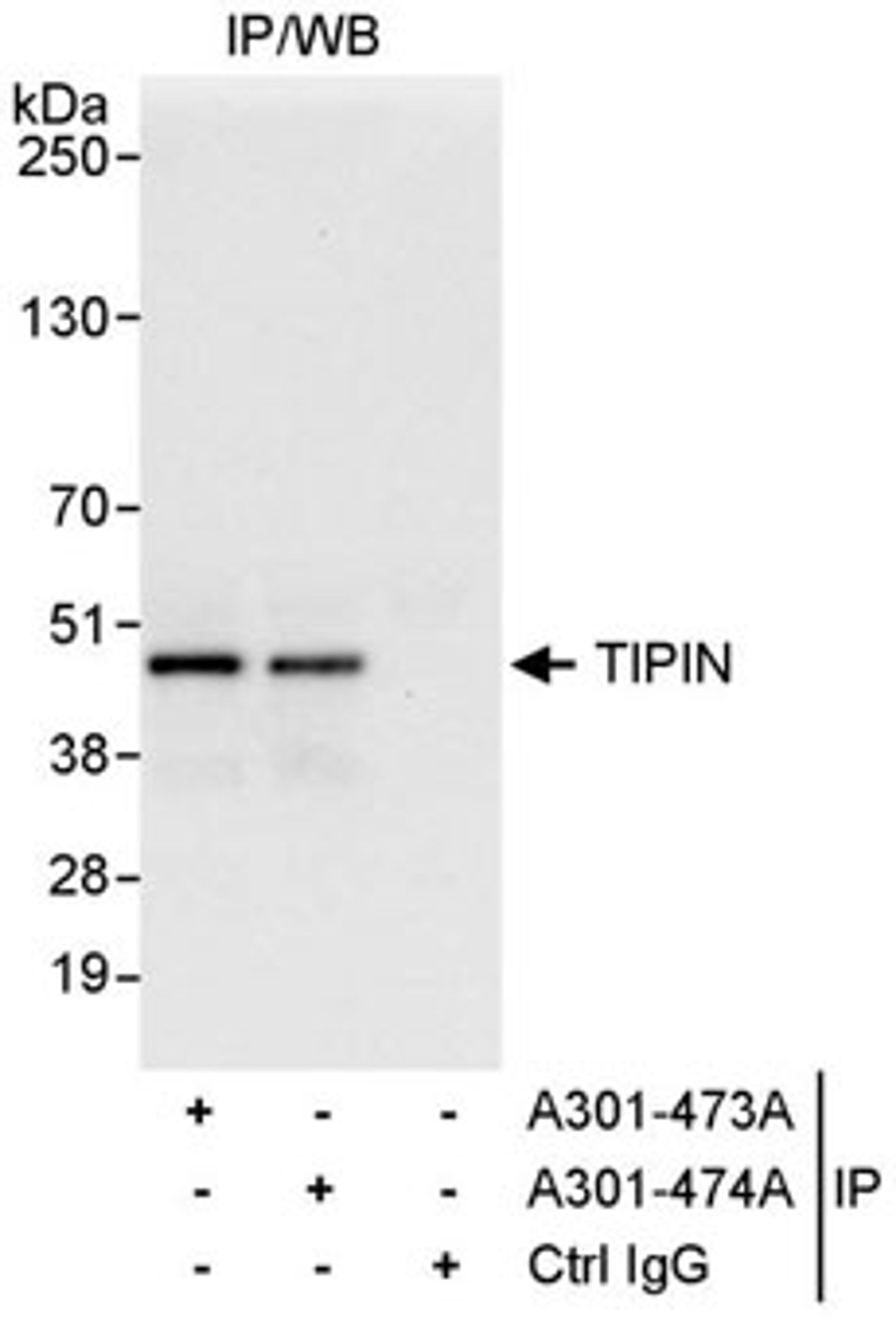 Detection of human TIPIN by western blot of immunoprecipitates.