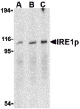 Western blot analysis of IRE1p in A-20 cell lysate with IRE1p antibody at (A) 0.5, (B) 1 and (C) 2 &#956;g/mL.