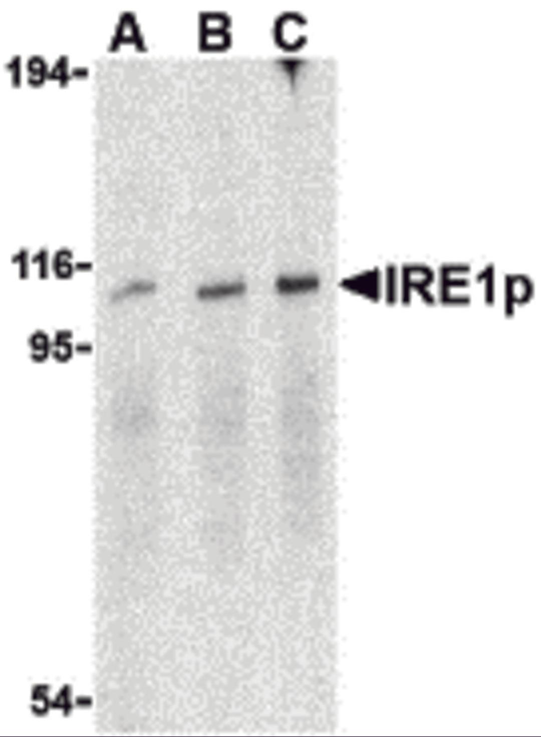 Western blot analysis of IRE1p in A-20 cell lysate with IRE1p antibody at (A) 0.5, (B) 1 and (C) 2 μg/mL.