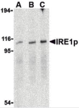 Western blot analysis of IRE1p in A-20 cell lysate with IRE1p antibody at (A) 0.5, (B) 1 and (C) 2 μg/mL.