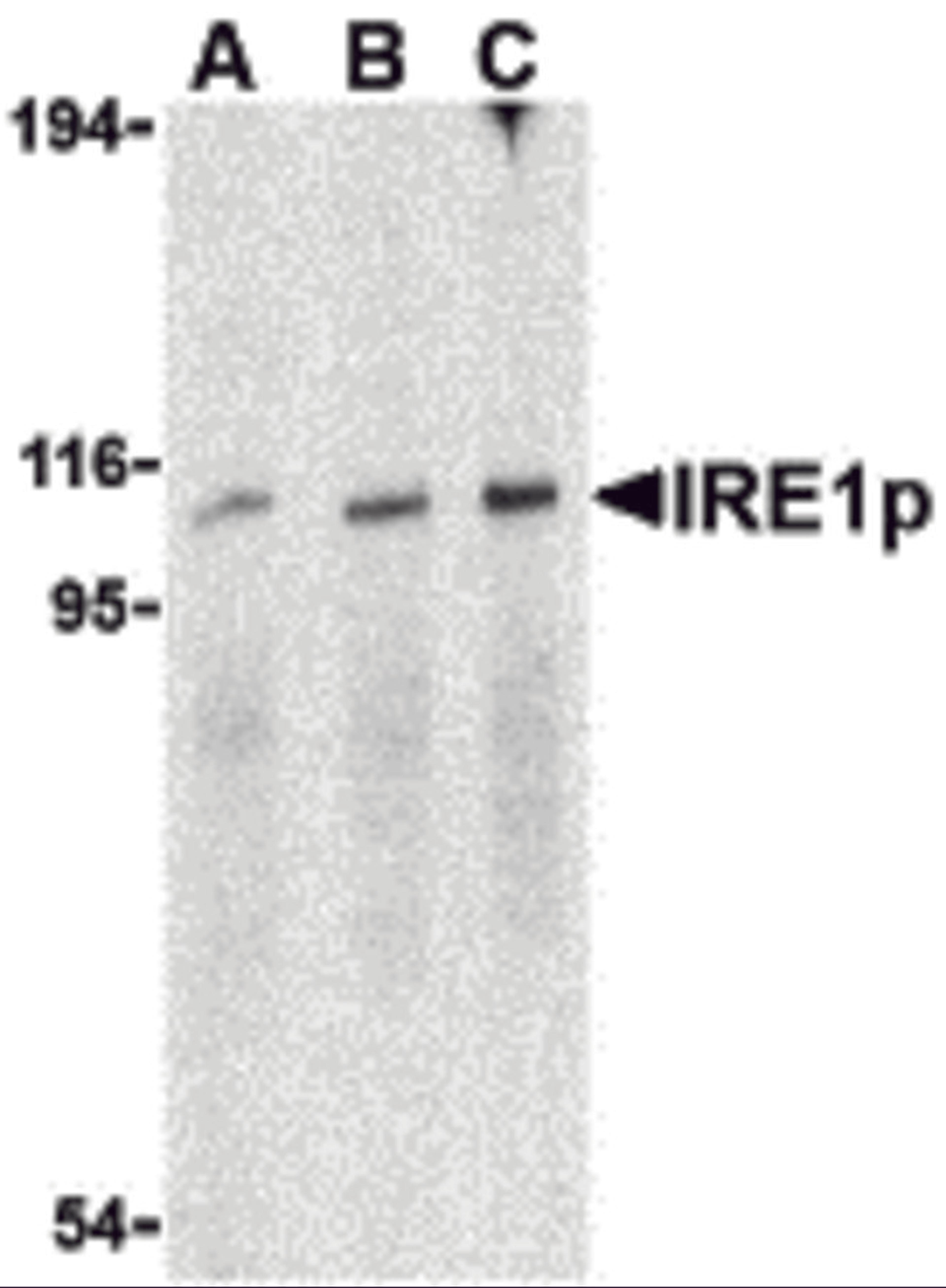 Western blot analysis of IRE1p in A-20 cell lysate with IRE1p antibody at (A) 0.5, (B) 1 and (C) 2 μg/mL.