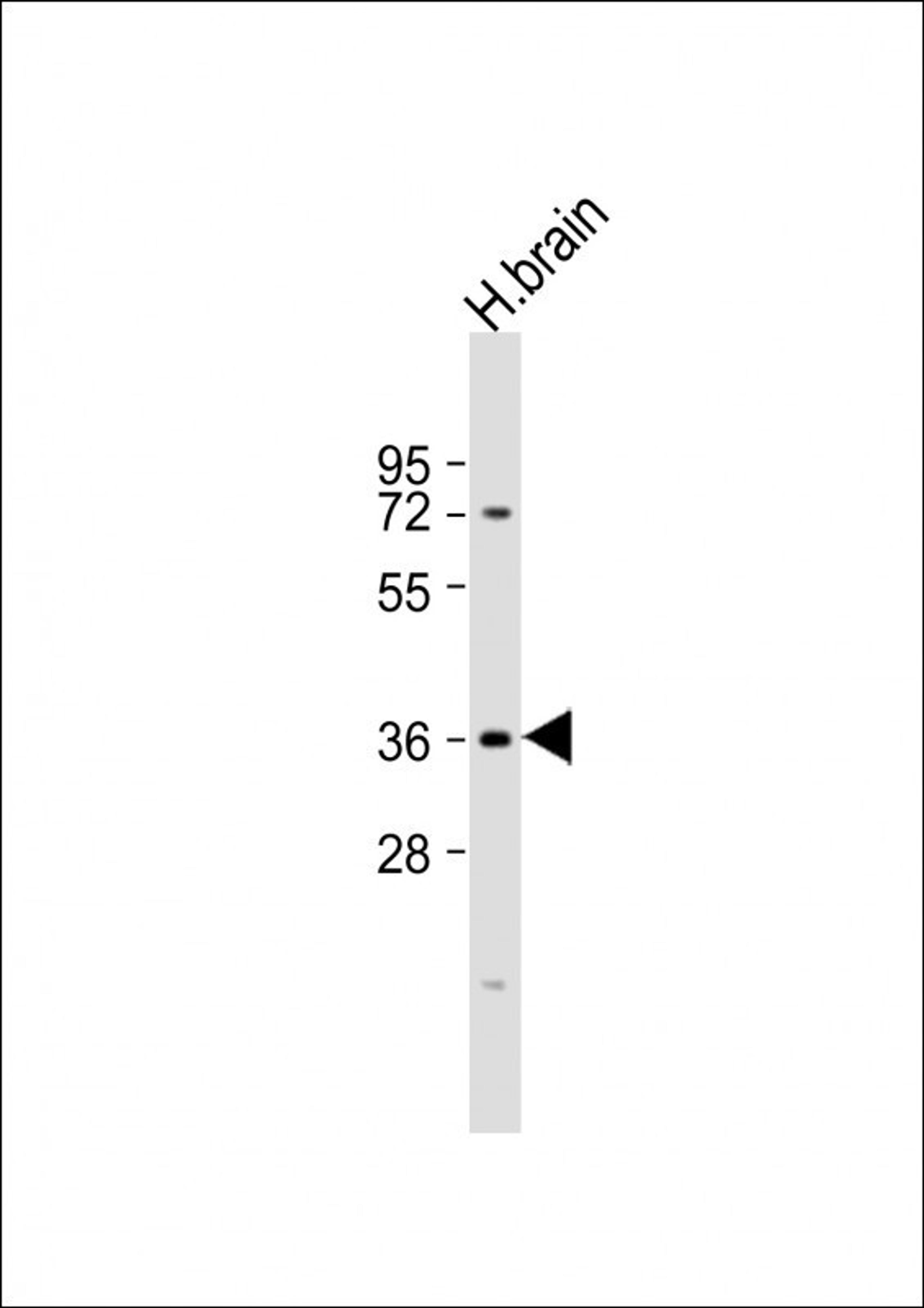 Western Blot at 1:1000 dilution + human brain lysate Lysates/proteins at 20 ug per lane.