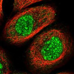 Immunocytochemistry/Immunofluorescence: HYPB Antibody [NBP1-89843] - Staining of human cell line A-431 shows positivity in nucleus & cytoplasm.