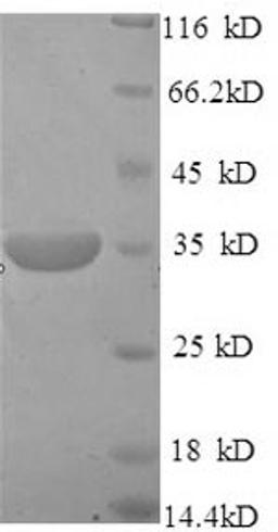 (Tris-Glycine gel) Discontinuous SDS-PAGE (reduced) with 5% enrichment gel and 15% separation gel.