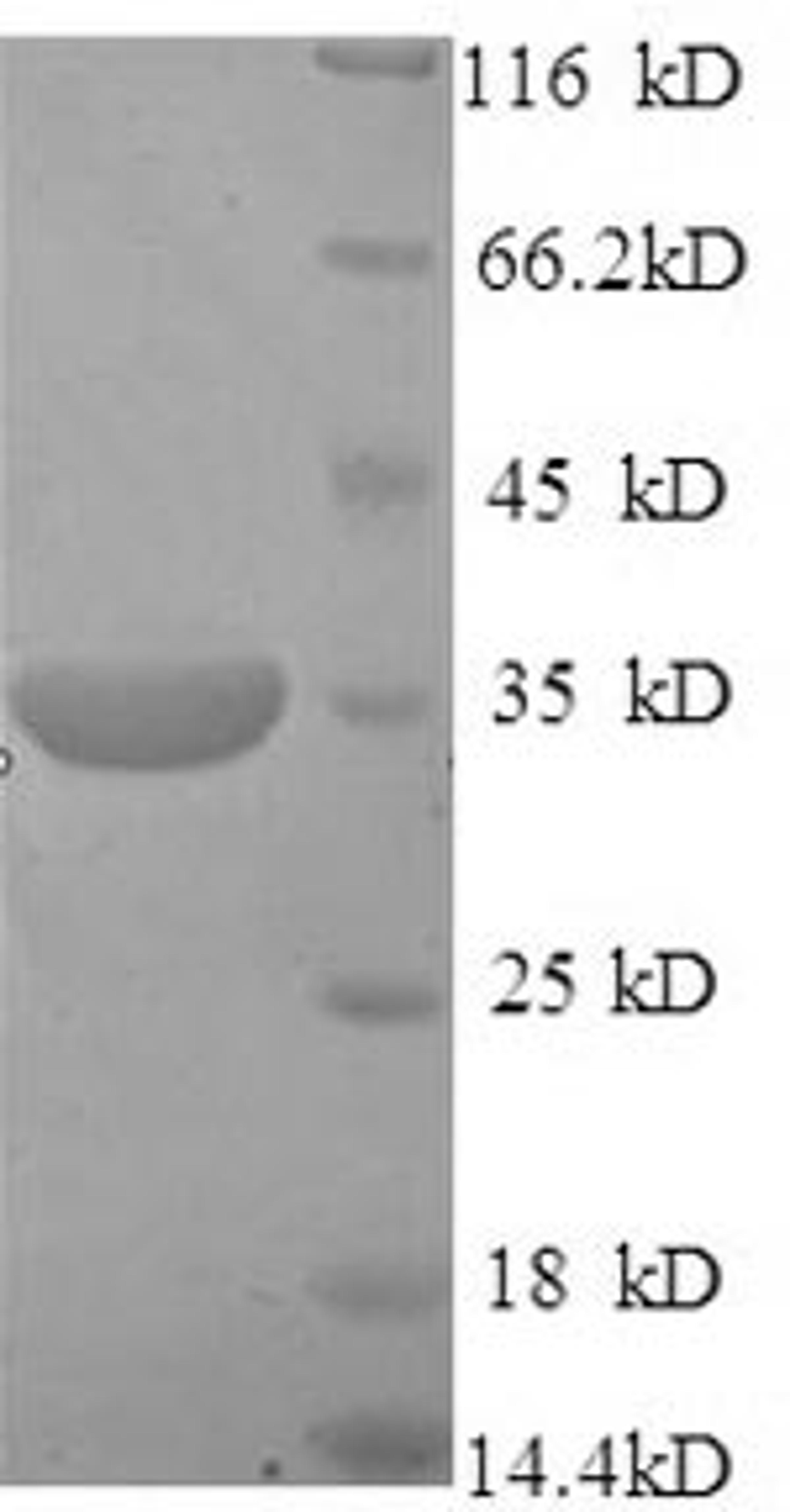 (Tris-Glycine gel) Discontinuous SDS-PAGE (reduced) with 5% enrichment gel and 15% separation gel.