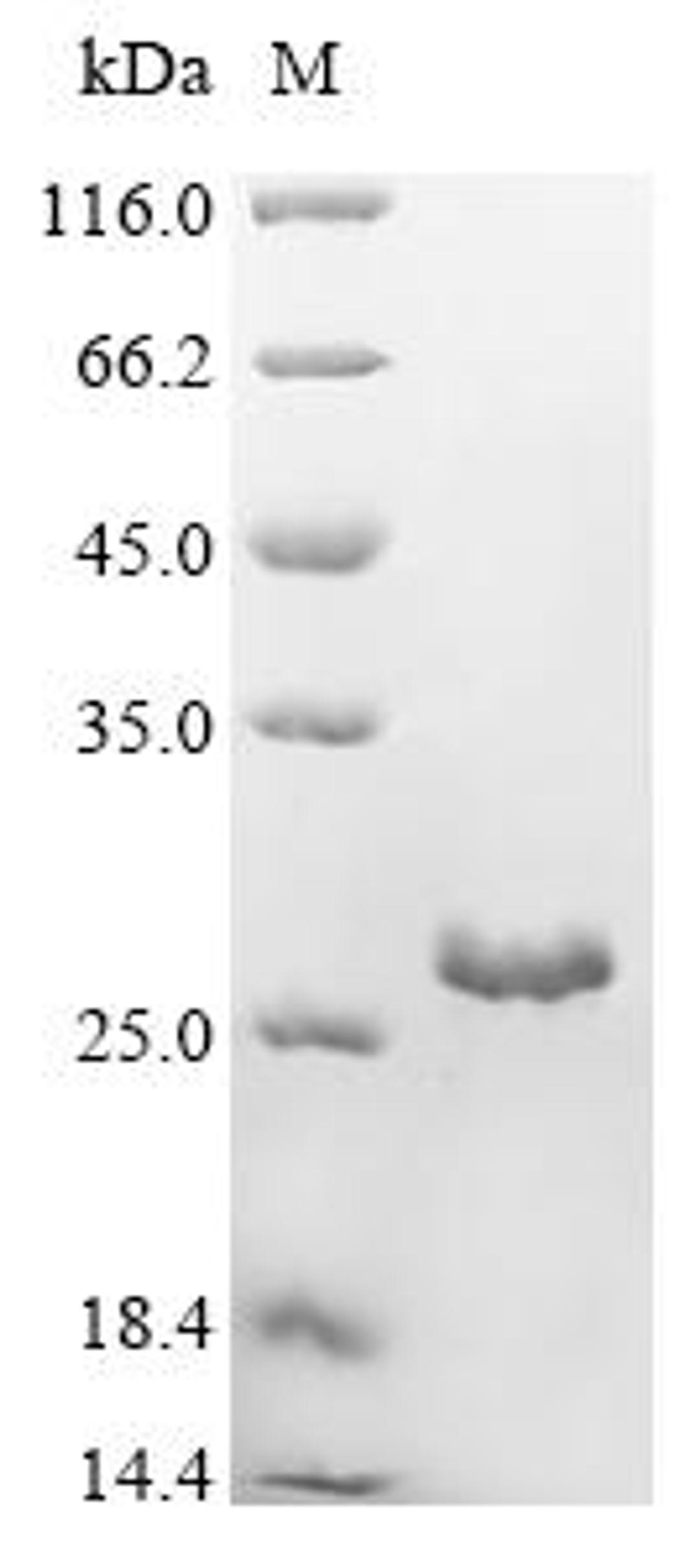 (Tris-Glycine gel) Discontinuous SDS-PAGE (reduced) with 5% enrichment gel and 15% separation gel.