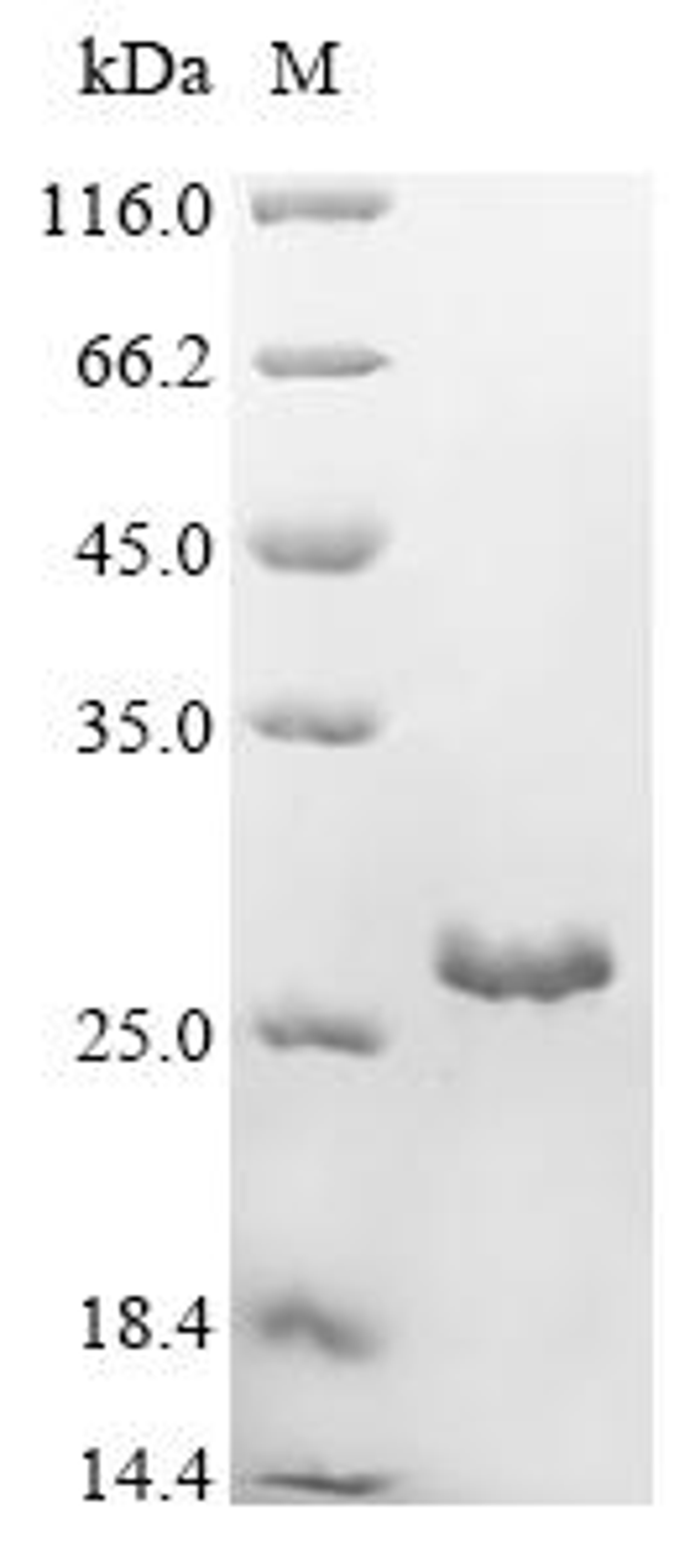 (Tris-Glycine gel) Discontinuous SDS-PAGE (reduced) with 5% enrichment gel and 15% separation gel.