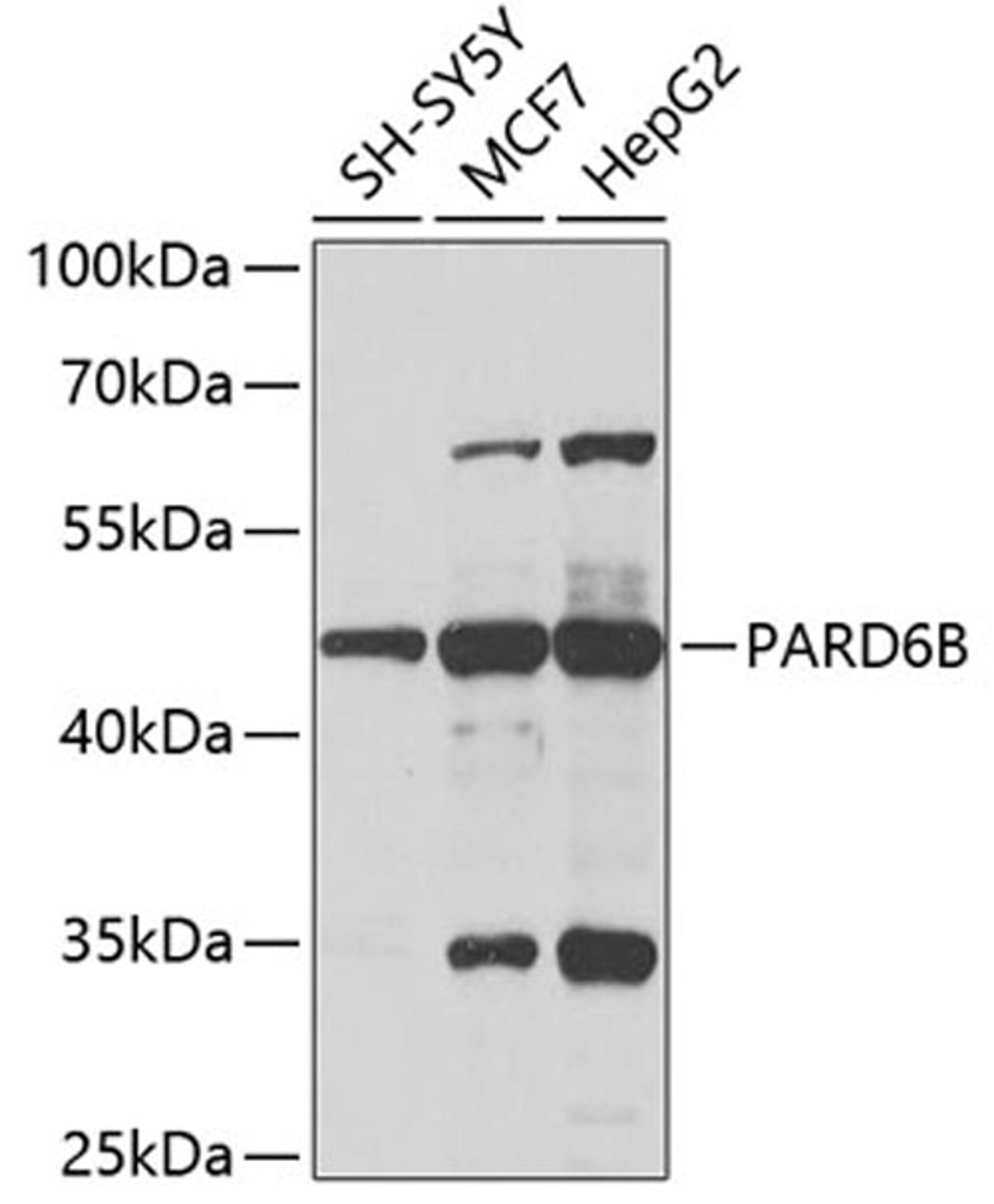 Western blot - PARD6B antibody (A5060)