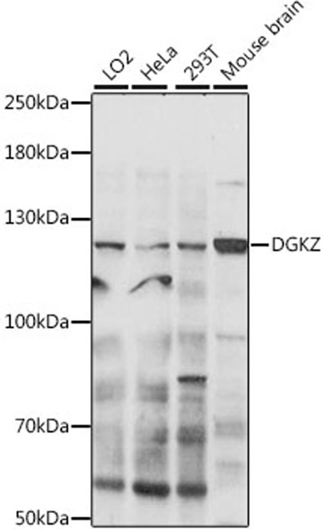 Western blot - DGKZ antibody (A16457)