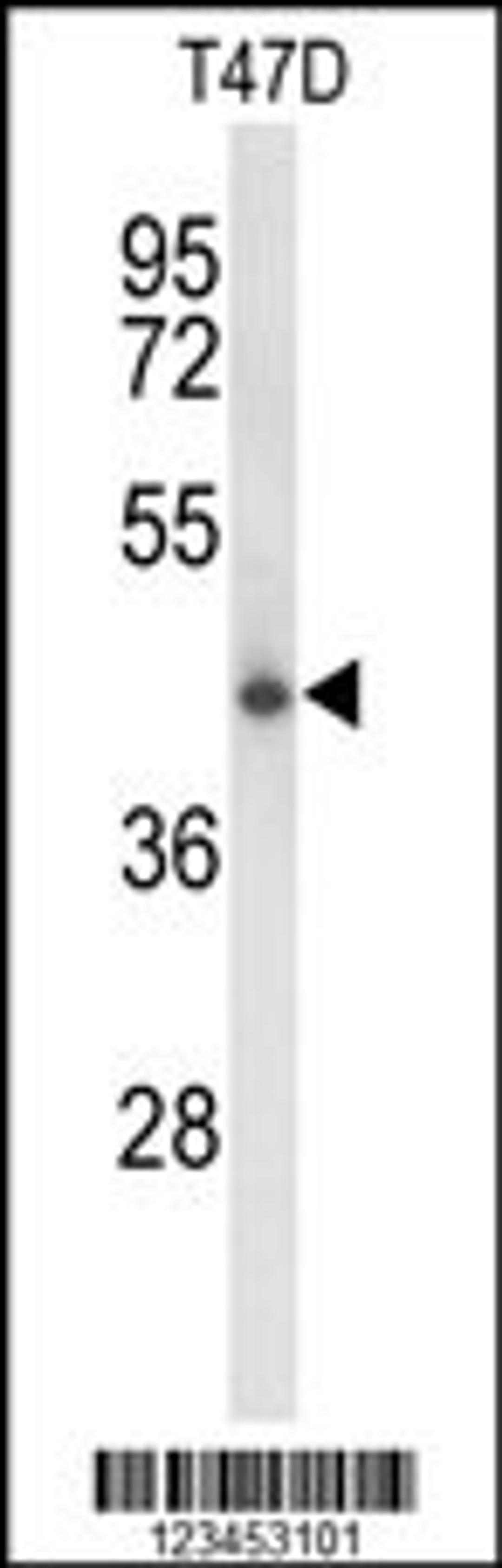 Western blot analysis of CLN5 Antibody in T47D cell line lysates (35ug/lane)