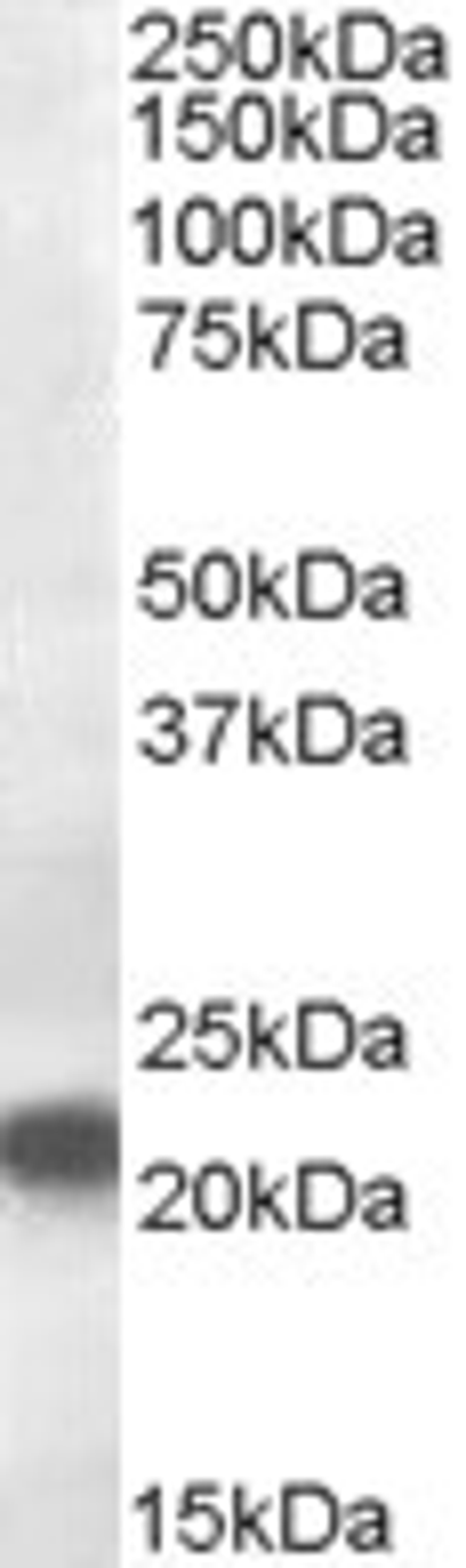 46-578 (0.5ug/ml) staining of Rat Kidney lysate (35ug protein in RIPA buffer). Primary incubation was 1 hour. Detected by chemiluminescence.