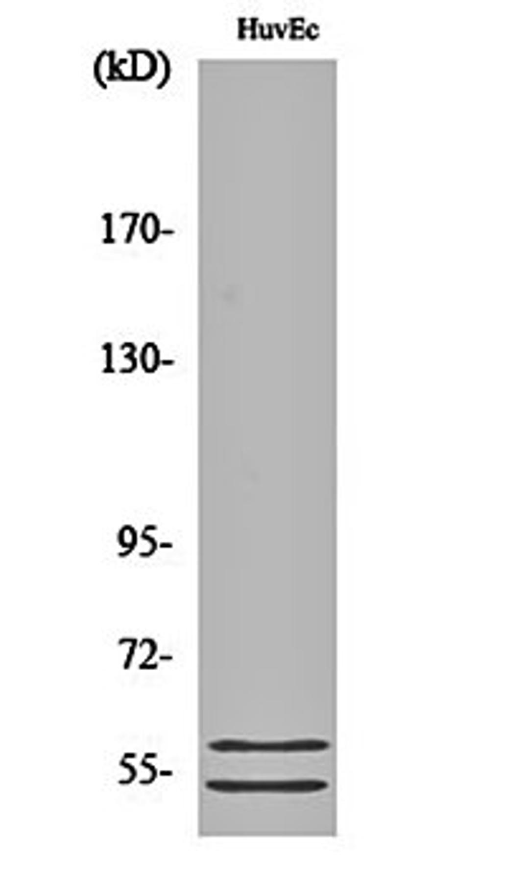 Western blot analysis of HuvEc cell lysates using CBG antibody