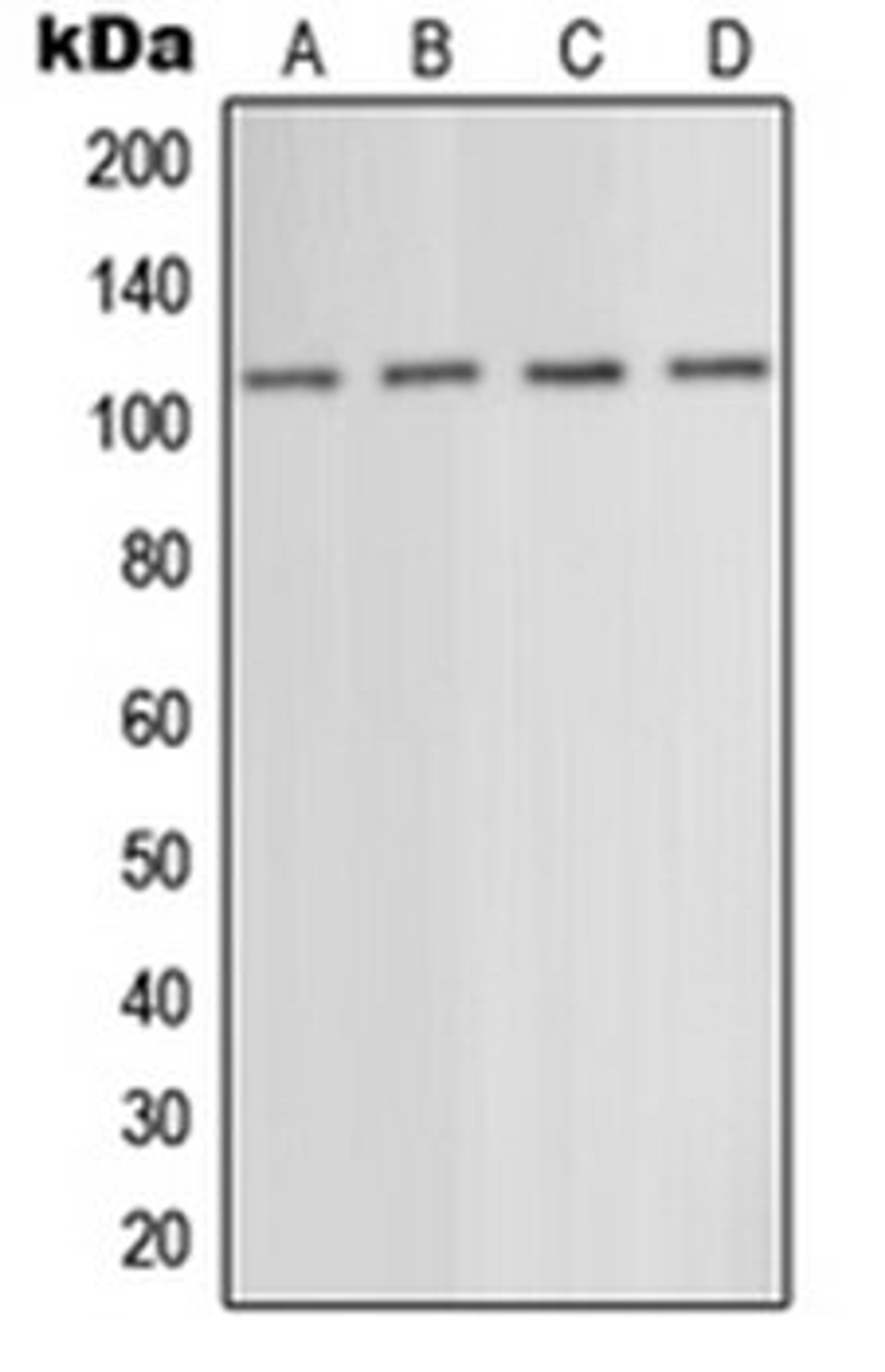 Western blot analysis of EOC20 (Lane 1), mouse liver (Lane 2), rat liver (Lane 3), rat brain (Lane 4) whole cell lysates using GRM5 antibody