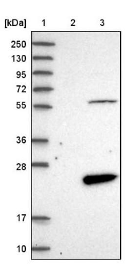 Western Blot: FAM167B Antibody [NBP1-88321] - Lane 1: Marker [kDa] 250, 130, 95, 72, 55, 36, 28, 17, 10<br/>Lane 2: Negative control (vector only transfected HEK293T lysate)<br/>Lane 3: Over-expression lysate (Co-expressed with a C-terminal myc-DDK tag (~3.1 kDa) in mammalian HEK293T cells, LY409985)