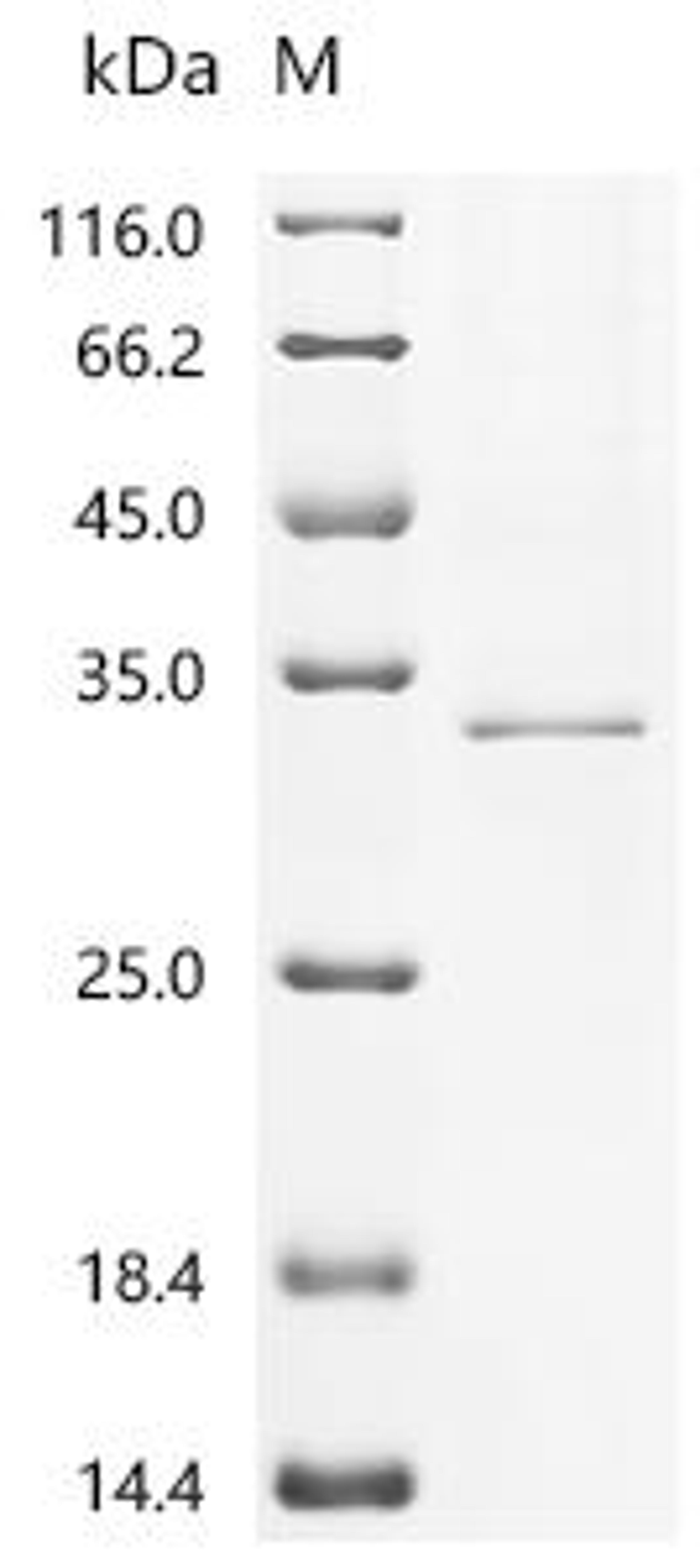 (Tris-Glycine gel) Discontinuous SDS-PAGE (reduced) with 5% enrichment gel and 15% separation gel.