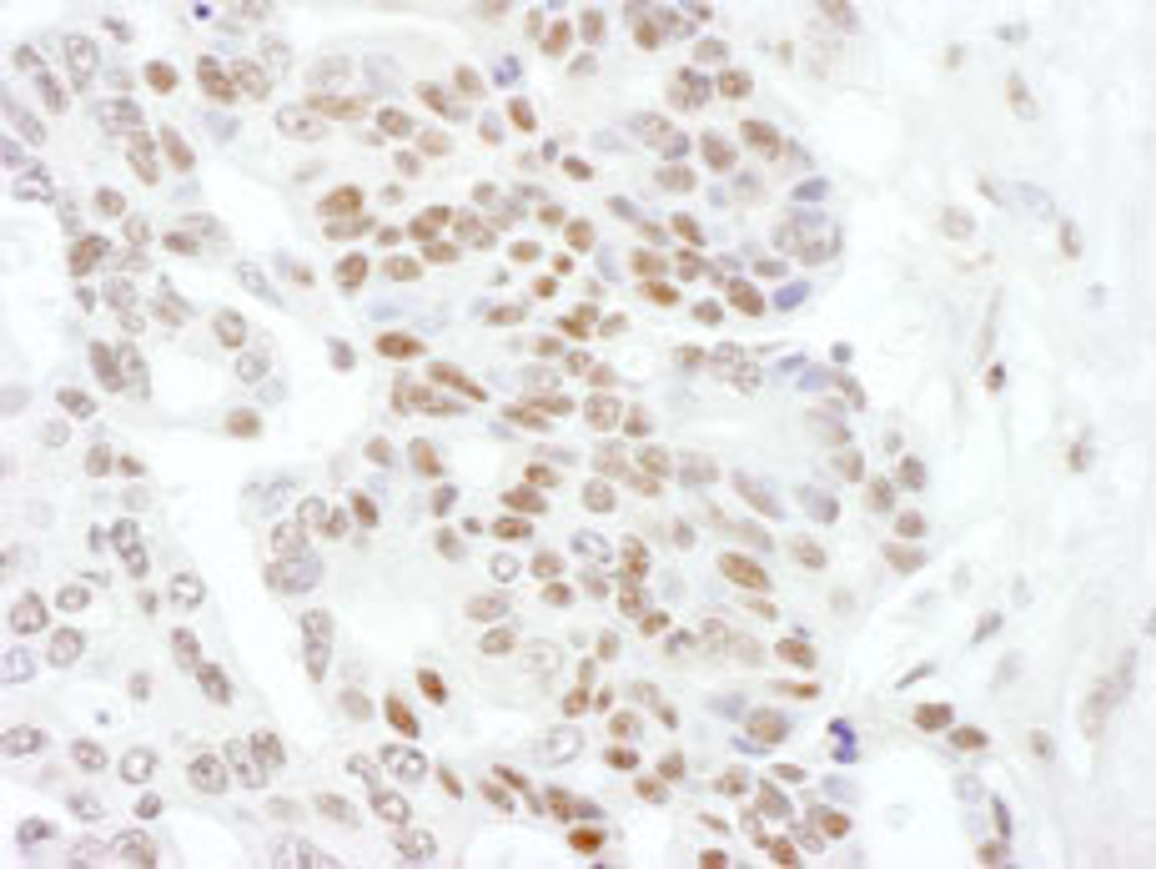 Detection of human Phospho RNA Polymerase II (S2) by immunohistochemistry.