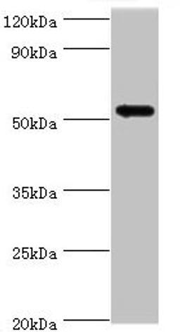 Western blot. All lanes: CAMK1G antibody at 5µg/ml + HL60 whole cell lysate. Secondary. Goat polyclonal to rabbit IgG at 1/10000 dilution. Predicted band size: 54, 52 kDa. Observed band size: 54 kDa