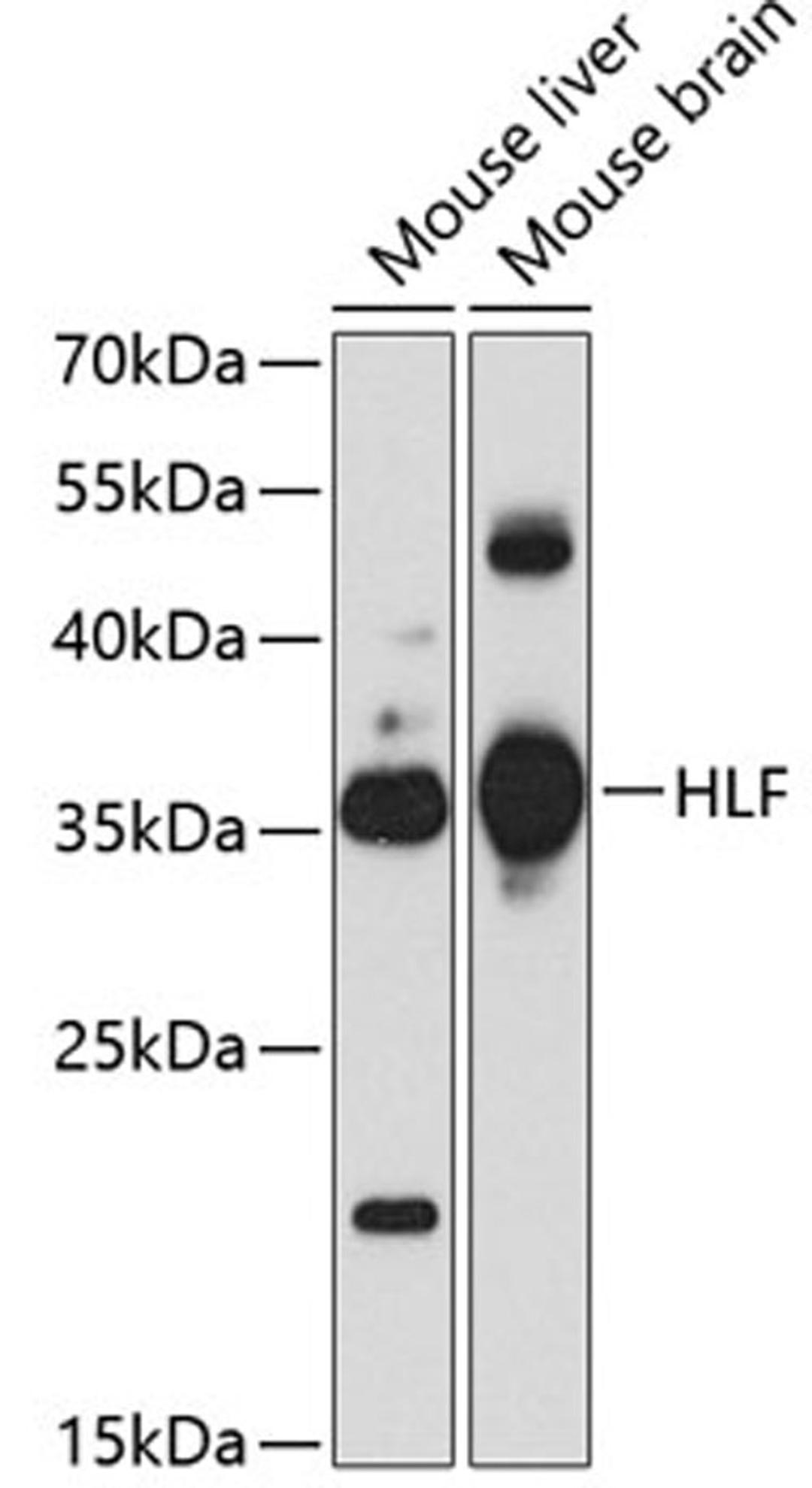 Western blot - HLF antibody (A3143)