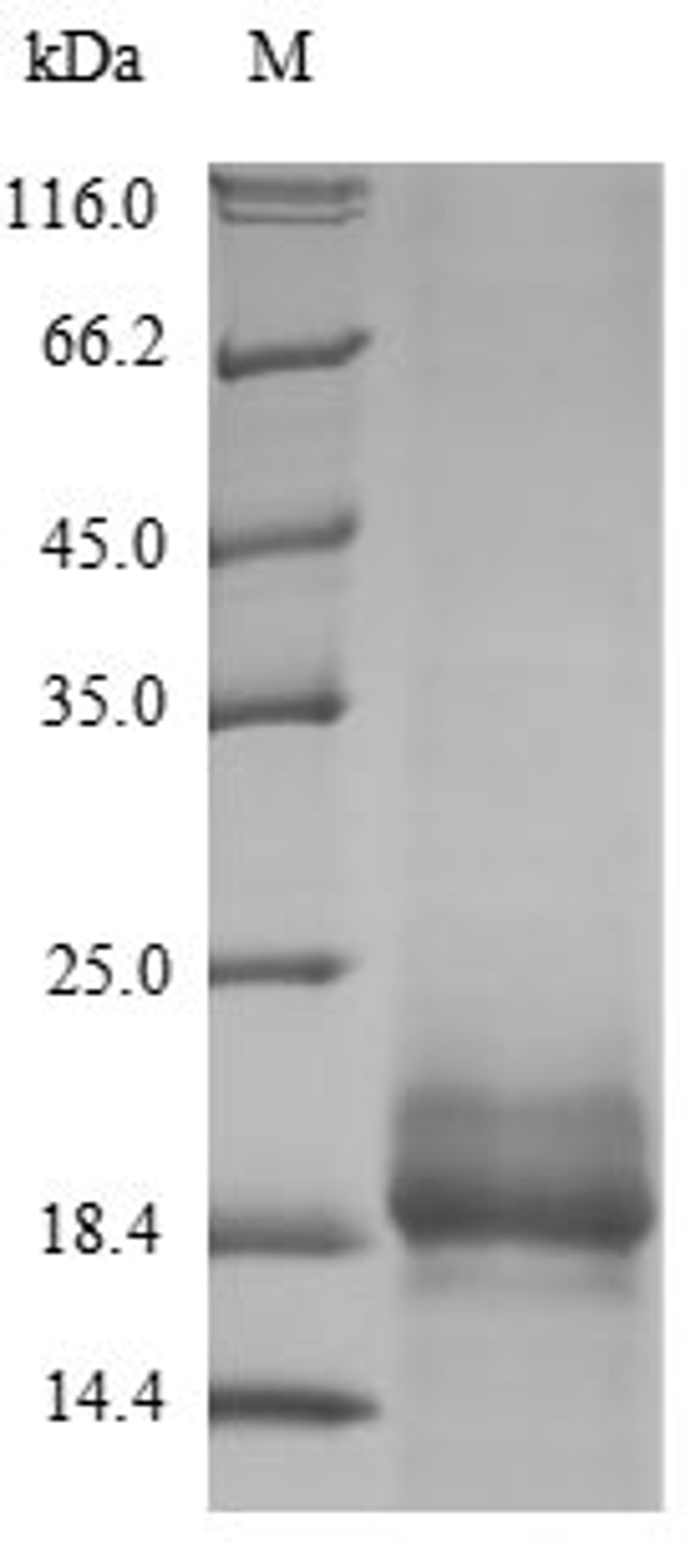(Tris-Glycine gel) Discontinuous SDS-PAGE (reduced) with 5% enrichment gel and 15% separation gel.