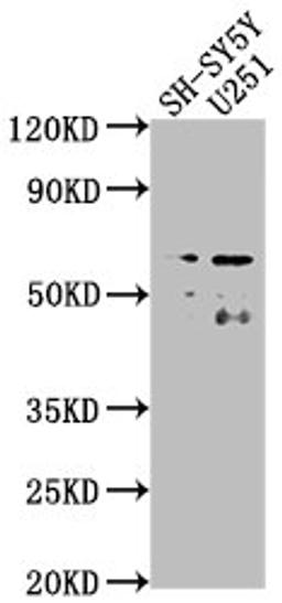 Western Blot. Positive WB detected in: SH-SY5Y whole cell lysate, U251 whole cell lysate. All lanes: CSRNP3 antibody at 1:2000. Secondary. Goat polyclonal to rabbit IgG at 1/50000 dilution. Predicted band size: 65, 59 kDa. Observed band size: 65 kDa.