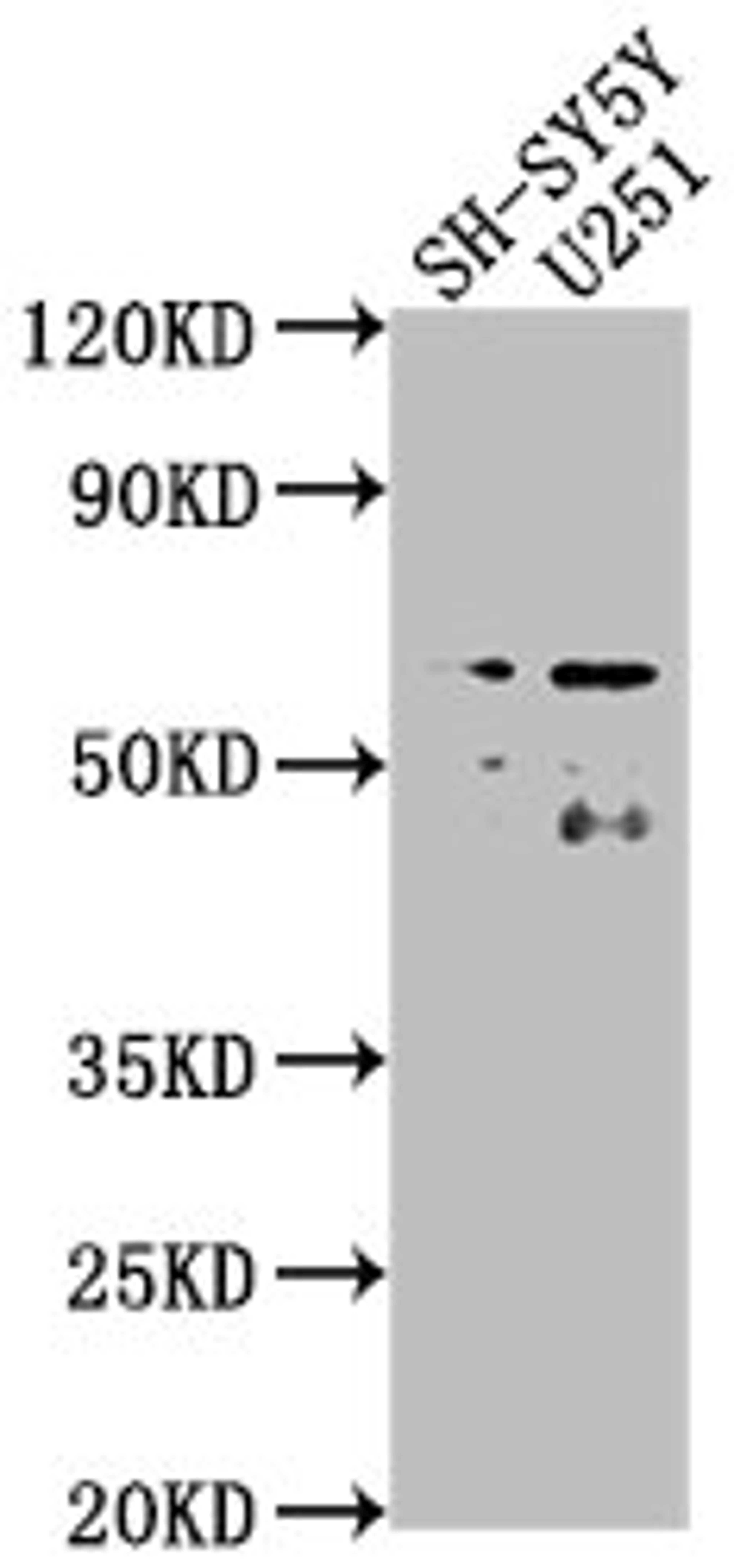 Western Blot. Positive WB detected in: SH-SY5Y whole cell lysate, U251 whole cell lysate. All lanes: CSRNP3 antibody at 1:2000. Secondary. Goat polyclonal to rabbit IgG at 1/50000 dilution. Predicted band size: 65, 59 kDa. Observed band size: 65 kDa.