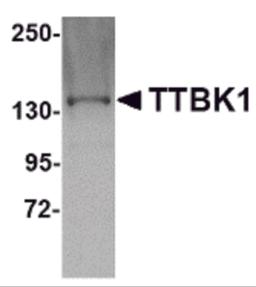 Western blot analysis of TTBK1 in Jurkat lysate with TTBK1 antibody at 1 &#956;g/mL.