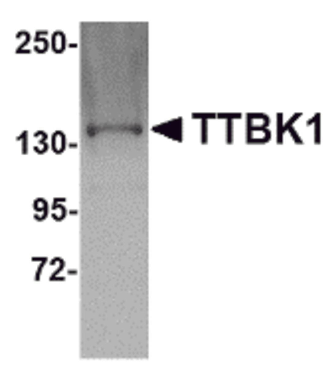 Western blot analysis of TTBK1 in Jurkat lysate with TTBK1 antibody at 1 μg/mL.