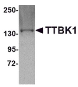 Western blot analysis of TTBK1 in Jurkat lysate with TTBK1 antibody at 1 μg/mL.