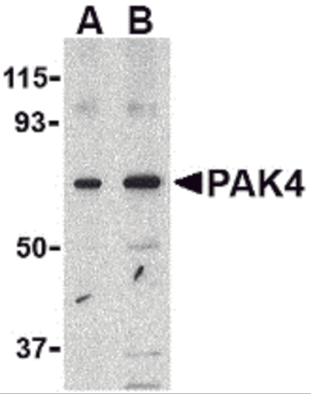 Western blot analysis of PAK4 in SW480 lysate with PAK4 antibody at (A) 1 and (B) 2 μg/mL.