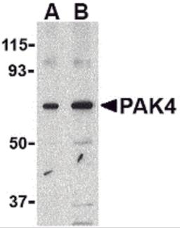 Western blot analysis of PAK4 in SW480 lysate with PAK4 antibody at (A) 1 and (B) 2 μg/mL.