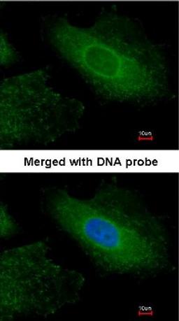 Immunocytochemistry/Immunofluorescence: Radixin Antibody [NBP1-31553] - Analysis of HeLa, using NBP1-31553 at 1:200 dilution.