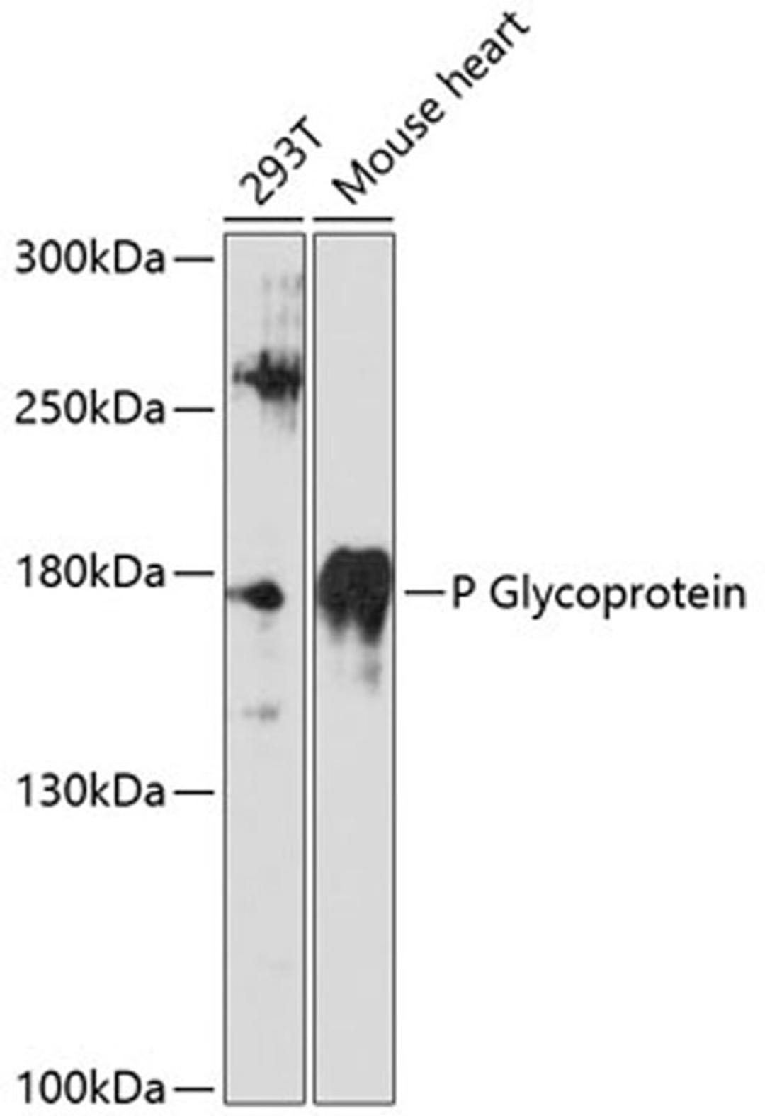 Western blot - P Glycoprotein antibody (A11758)