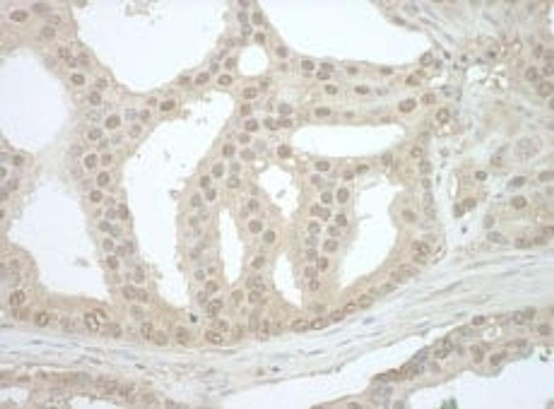 Detection of human Bin1 by immunohistochemistry.