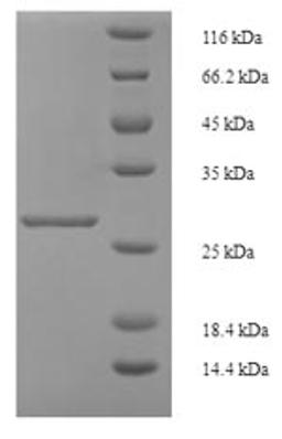 (Tris-Glycine gel) Discontinuous SDS-PAGE (reduced) with 5% enrichment gel and 15% separation gel.