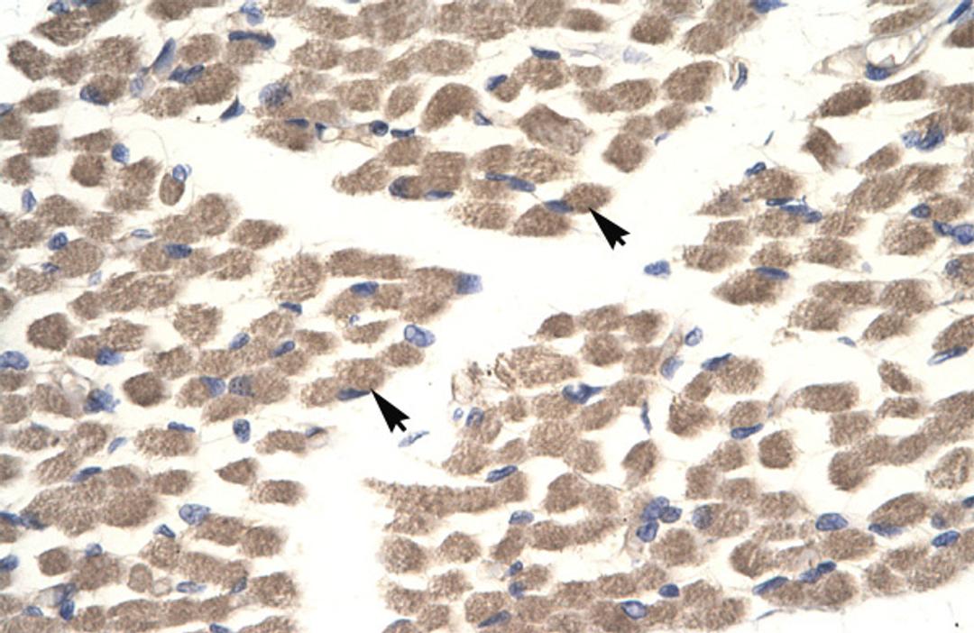 Antibody used in IHC on Human Muscle.