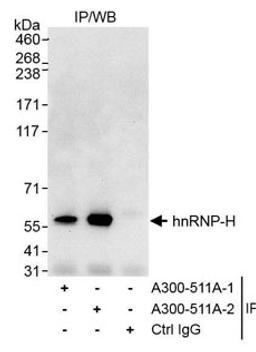 Detection of human hnRNP-H by western blot of immunoprecipitates.