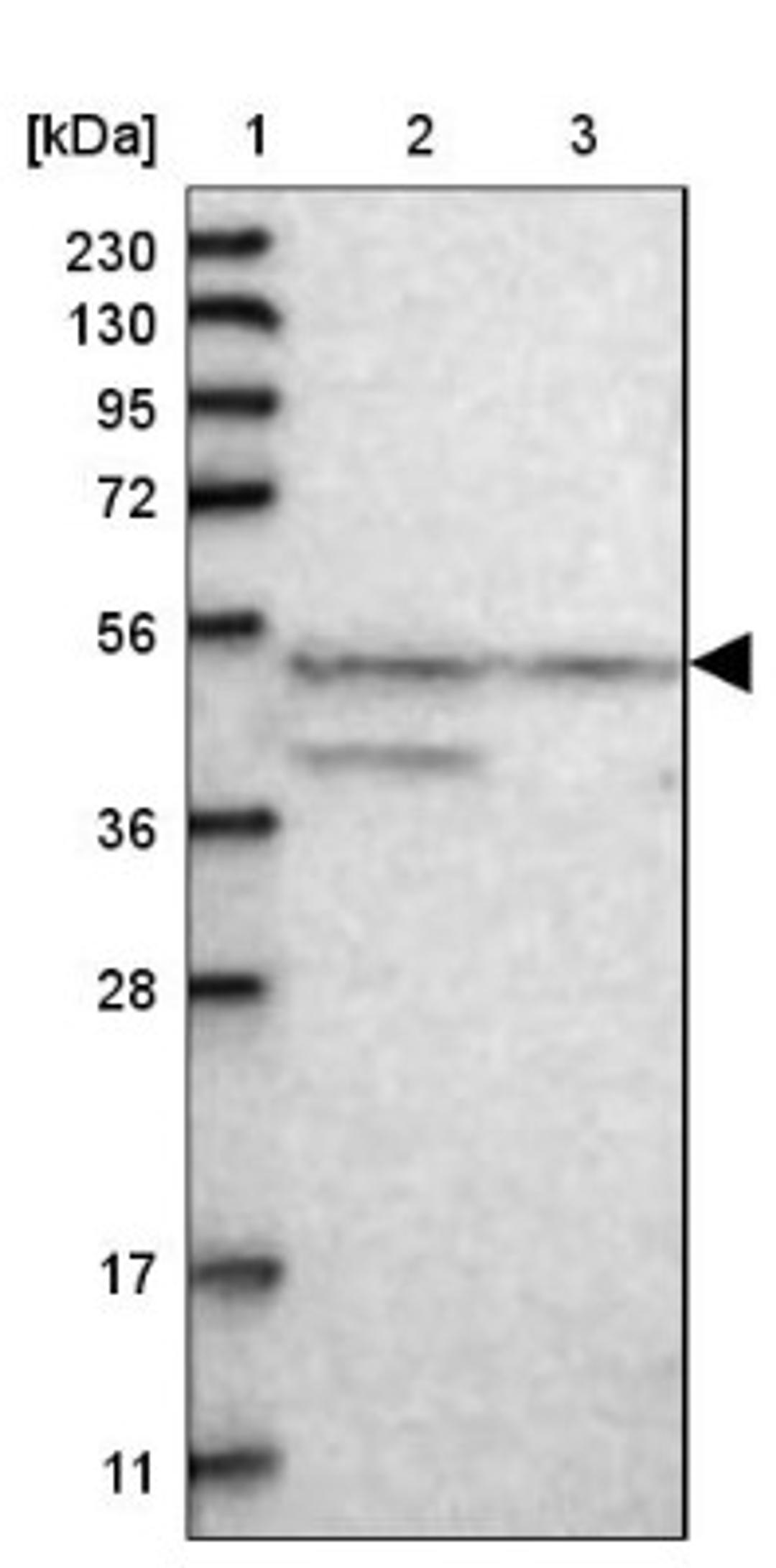 Western Blot: DUSP12 Antibody [NBP1-84961] - Lane 1: Marker [kDa] 230, 130, 95, 72, 56, 36, 28, 17, 11<br/>Lane 2: Human cell line RT-4<br/>Lane 3: Human cell line U-251MG sp