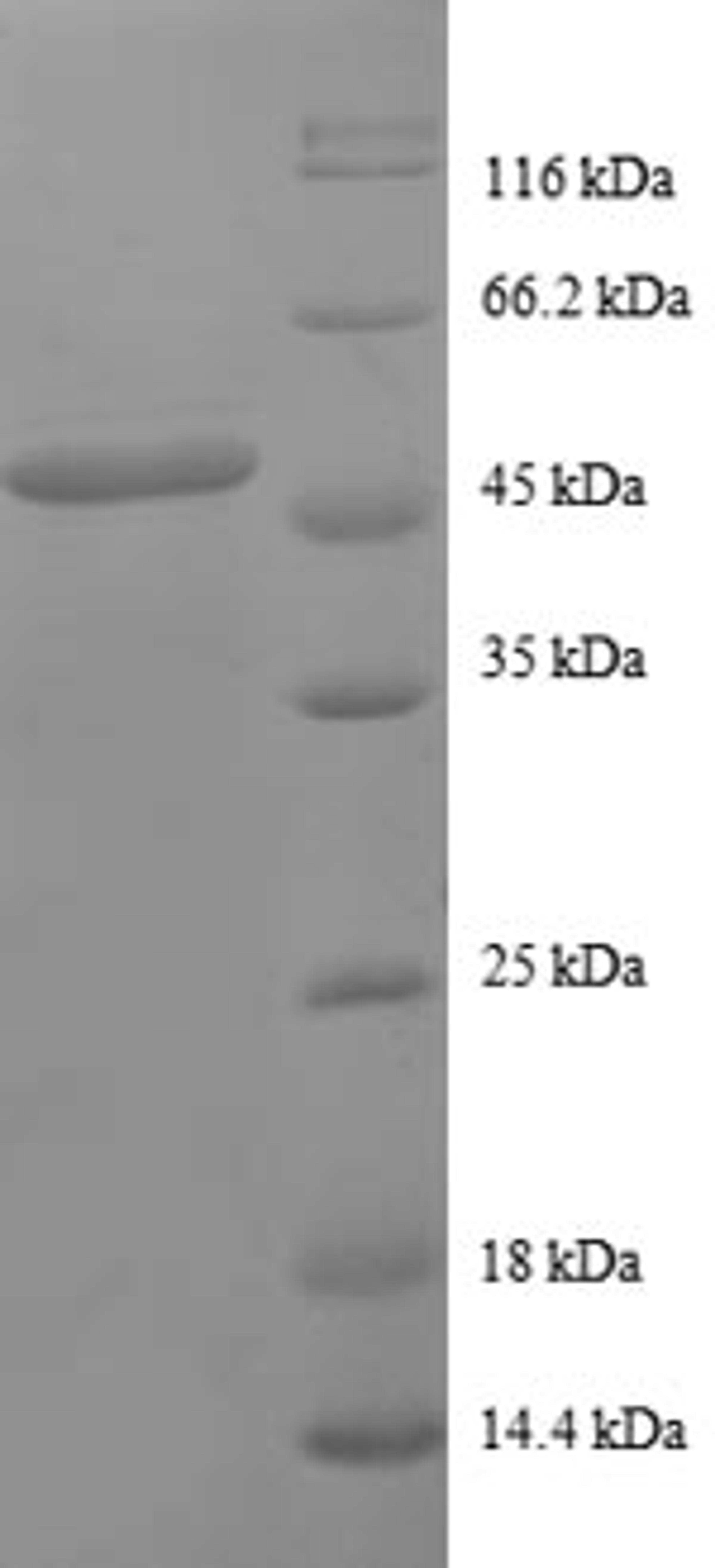 (Tris-Glycine gel) Discontinuous SDS-PAGE (reduced) with 5% enrichment gel and 15% separation gel.
